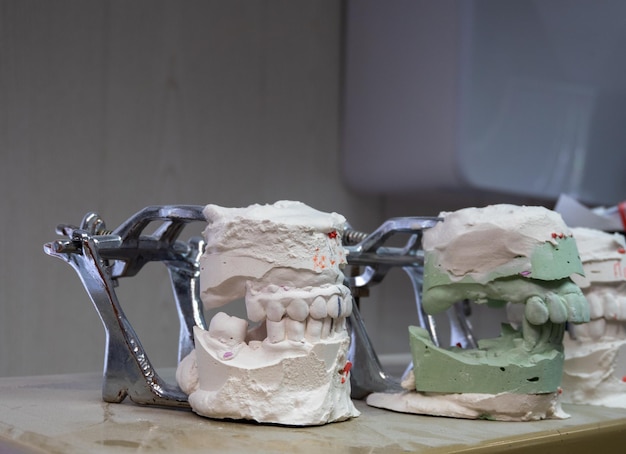 plaster cast of teeth set of white teeth on the table