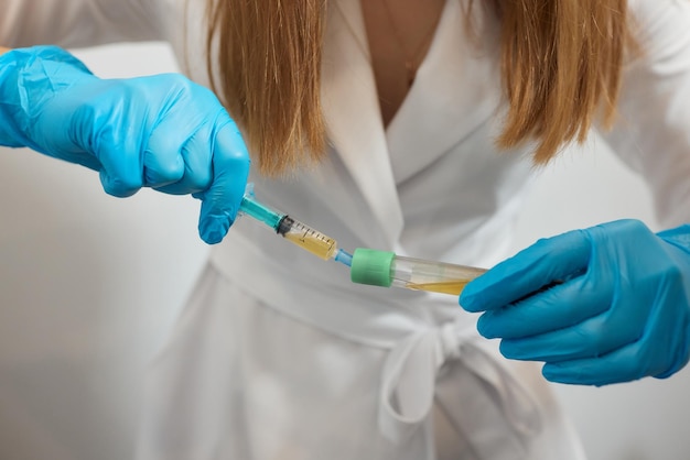 PlateletRich plasma preparation Plasma in syringe Centrifuge