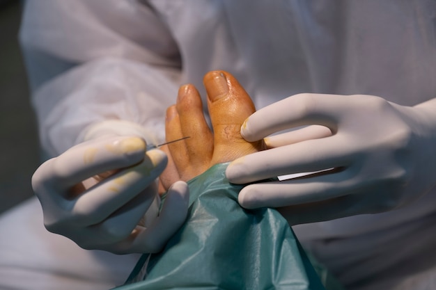 Podiatrist doctor examines the foot and prepares surgery