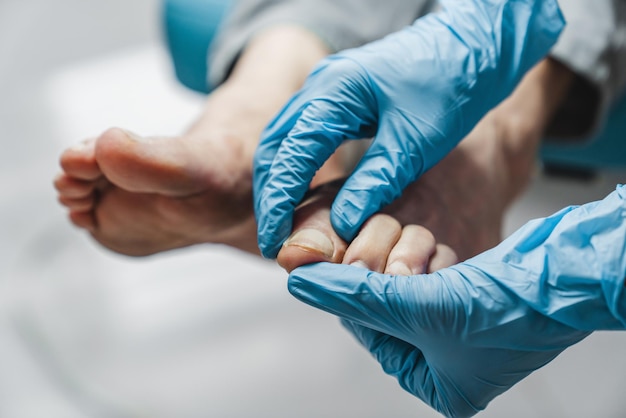 Photo podiatrist treating feet during procedure