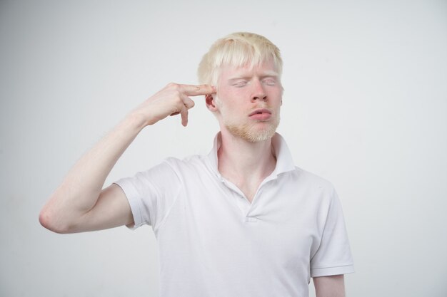 Portrait of an albino man in a studio