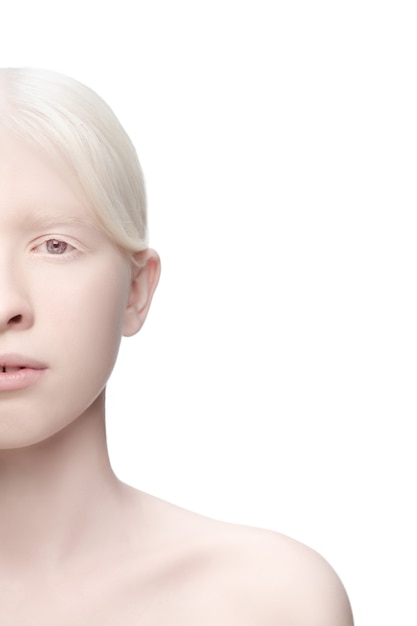 Portrait of beautiful albino woman isolated on white studio background