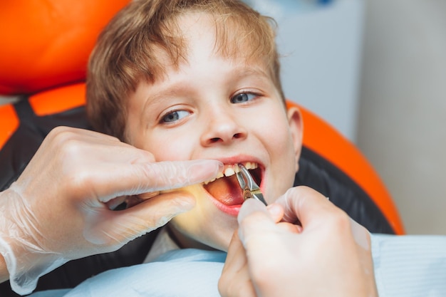 Portrait of a child patient and the hands of a pediatric dentist with dental forceps closeup painless extraction of teeth pediatric dentistry