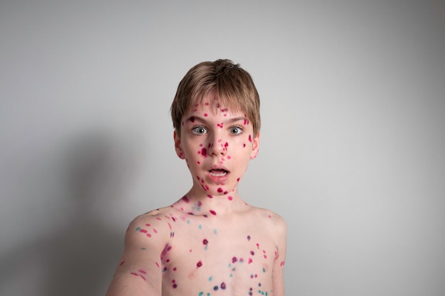 Portrait of an emotional little boy with chicken pox on the background of a gray wall