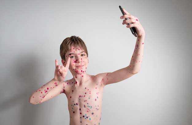 Portrait of an emotional little boy with chicken pox on the background of a gray wall