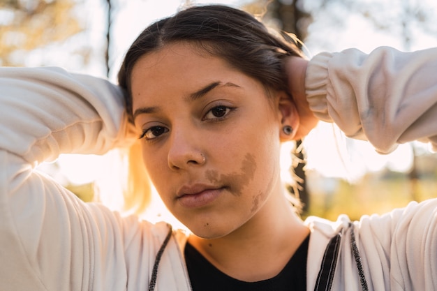 Portrait of a pretty girl with a birthmark on her face in the open air sunset.