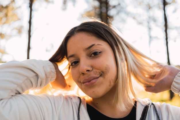 Portrait of a pretty girl with a birthmark on her face in the open air.