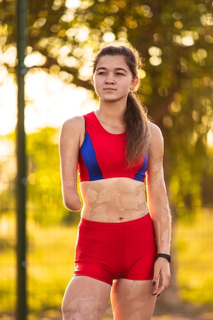 Portrait young woman athlete with an amputated arm and burns on her body Outdoor training at sunset