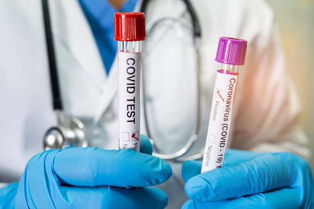 Positive blood infection sample in test tube for omicron covid19 coronavirus in lab Scientist holding to check and analyze for patient in hospital