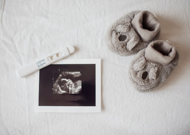 Pregnancy test little shoes and x ray photo