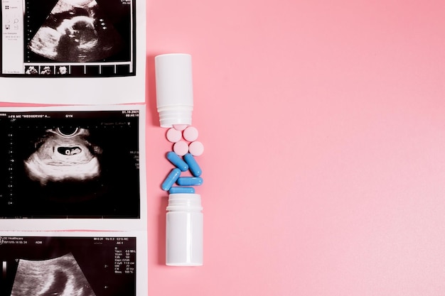 Pregnancy Treatment during pregnancy Threat to the fetus Copy space