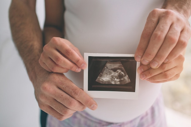 Pregnant couple holding ultrasound scan. Concept of Pregnancy health care