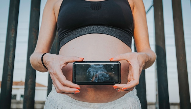 Pregnant Woman Holding Ultrasound of Her Baby on the mobile phone