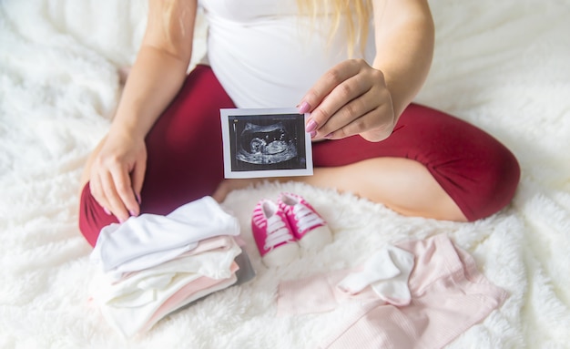 A pregnant woman holds a snapshot of an ultrasound in her hands. Selective Focus.