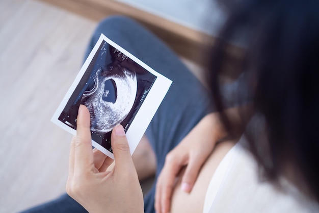 A pregnant woman is looking at an ultrasound photo of fetus Mother gently touches the baby on stomachWomen are pregnant for 23 days or during the first trimester