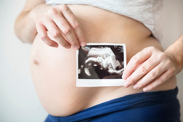 Pregnant woman showing fetus ultrasound photo