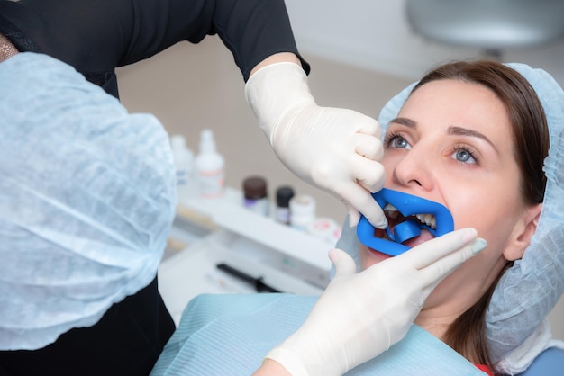 Preparing the oral cavity for whitening with an ultraviolet lamp Closeup