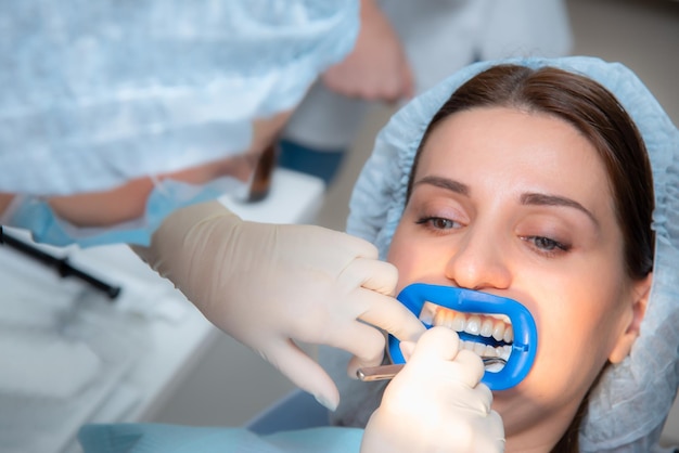 Preparing the oral cavity for whitening with an ultraviolet lamp Closeup