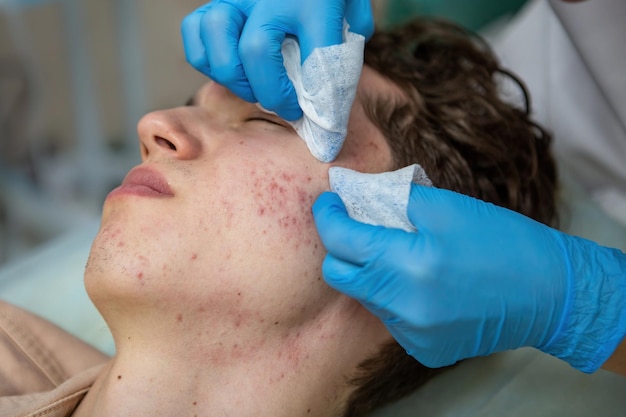 A procedure for mechanical or manual face cleansing by a beautician Professional skin peeling