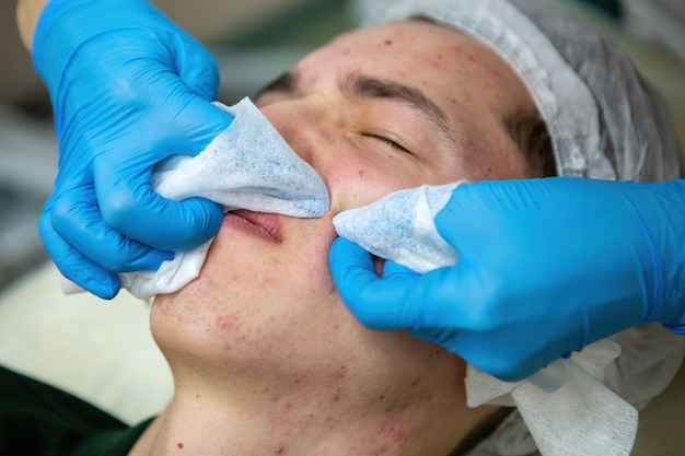 A procedure for mechanical or manual face cleansing by a beautician Professional skin peeling