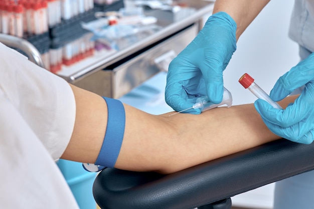 The process of taking a blood test from a vein