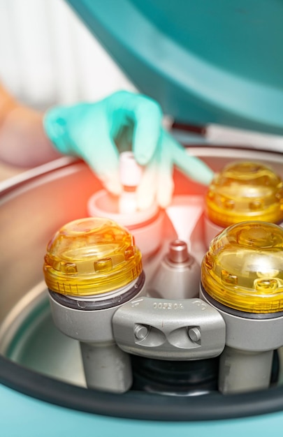 Professional centrifuge plasma preparation Blood samples analysing in modern hospital laboratory