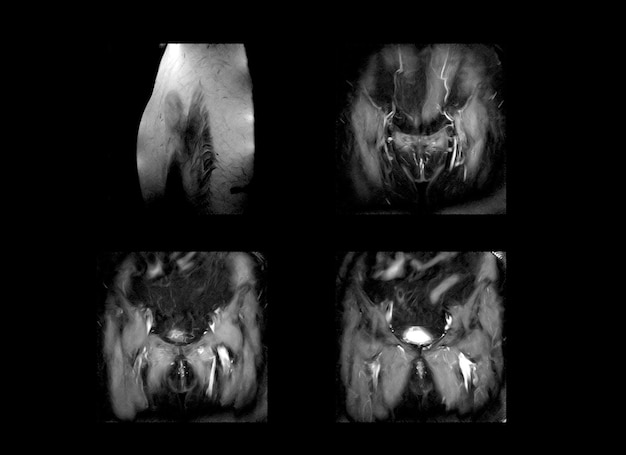 Professional ct scan and MRI xray images