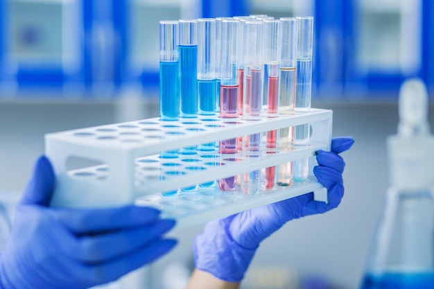 Professional laboratory. Selective focus of test tubes with chemical reagents standing in the test tube rack