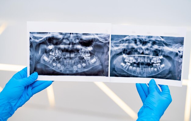 Professional teeth xray screening Diagnosing dental modern technologies