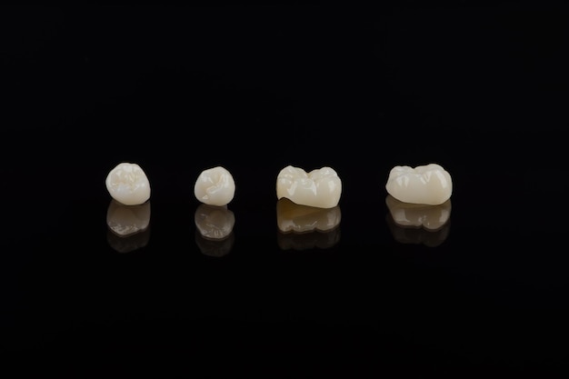 Qualified anatomic ceramic and zirconia crowns of human teeth close up macro isolated on black