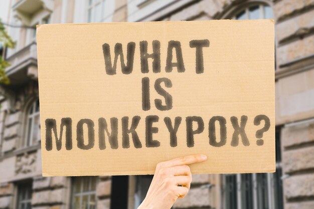 The question What is monkeypox is on a banner in men's hands with blurred background Diagnosis Headache Medical Outbreak Treatment Swollen Human Pox Disease Epidemic Virus Health