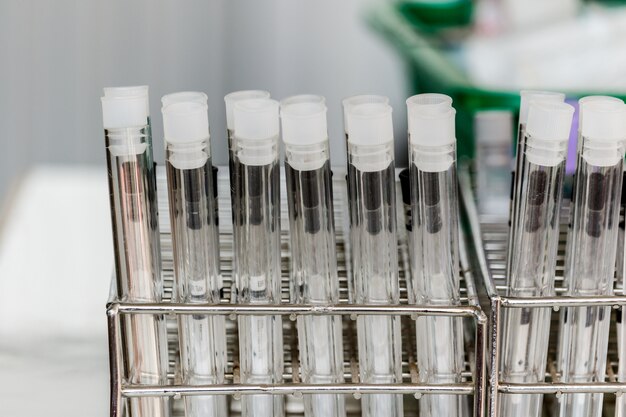 rack with chemical test tubes  in laboratory blue background