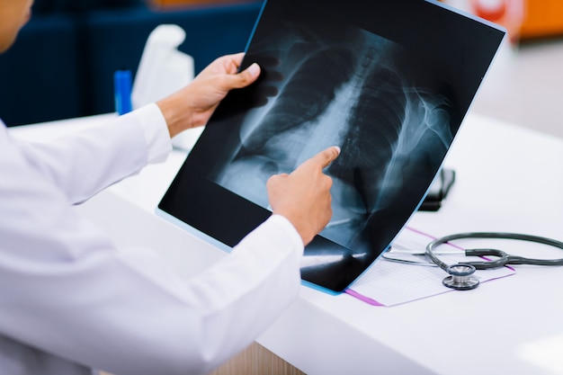 Radiology doctor examining at chest x ray film of patient at health care clinic