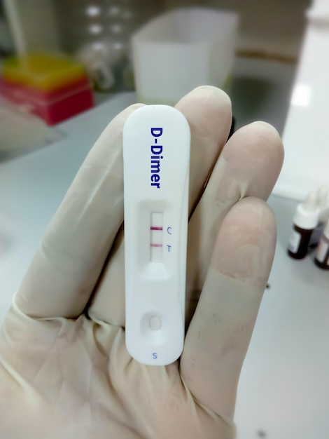 Rapid diagnostic cassette for D dimer test