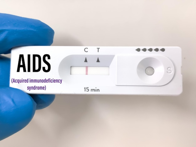 Rapid test cassette for AIDS (acquired immunodeficiency syndrome) test at medical laboratory