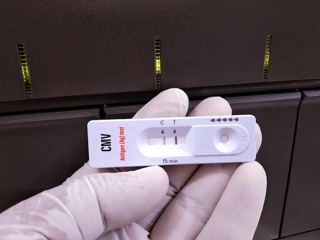 Rapid test cassette for Ramsay Hunt Syndrome (RHS) test at medical laboratory.