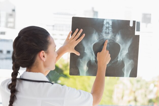 Rear view of a female doctor examining x-ray