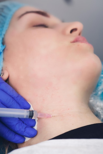 Rejuvenation of female neck skin with mesotherapy injections in a cosmetic clinic neck skin contouring mesotherapy and biorevitalization