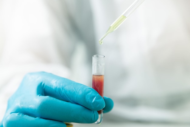 Researchers test blood samples in the laboratory.