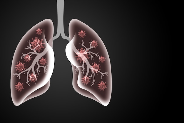 Respiratory virus and coronavirus outbreak. coronavirus or COVID-19, the virus that causes pneumonia as a medical health risk with infected human lungs. 3D rendering