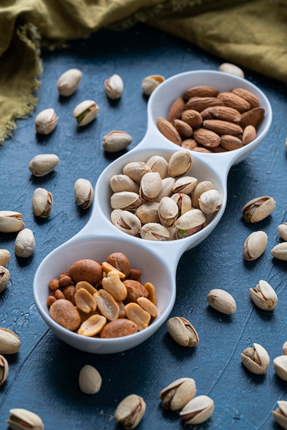 Roasted Nuts And Salted Pistachios In White Ceramic Bowl