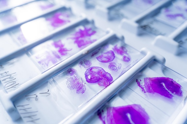 Rows of microscope glass slide in the cells