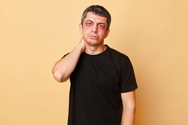 Sad upset beaten man in black Tshirt with bruises and abrasions on his face isolated over beige background suffering from violence feeling pain in neck