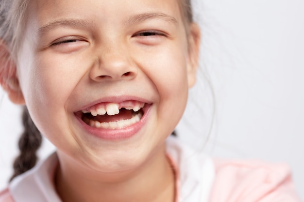 A school-age girl without a front tooth is laughing. Change of teeth.