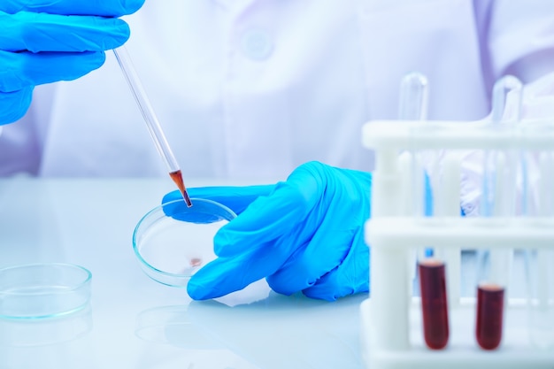 Scientist analyzing a blood sample for testing