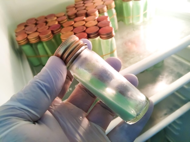 Scientist holding solid LowensteinJensen agar medium bottle. Culture for Mycobacterium tuberculosis