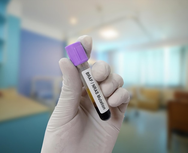 Scientist holds blood sample for BRAFNRAS Mutation test with laboratory background