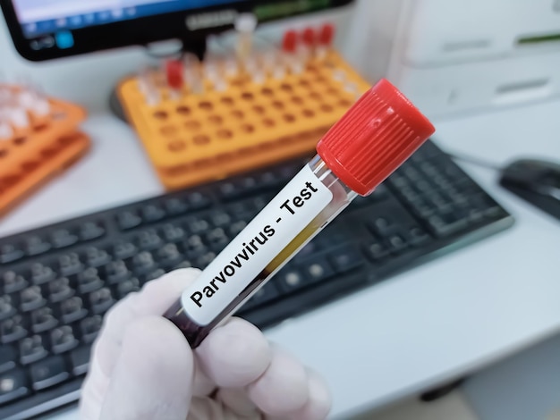 Scientist holds blood sample for Parvovirus test.