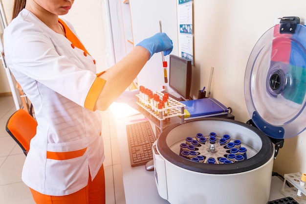 Scientist loading a sample to centrifuge Medical equipment A blood test for the virus Coronavirus 2019nCoV Blood Sample