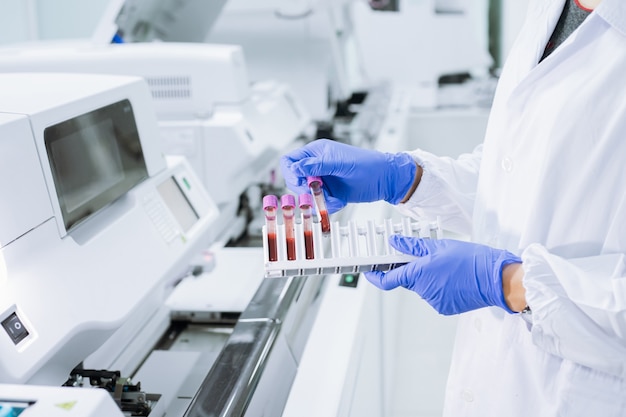 Scientist wear glove holding test tube in sample rack to check qulity of sample.